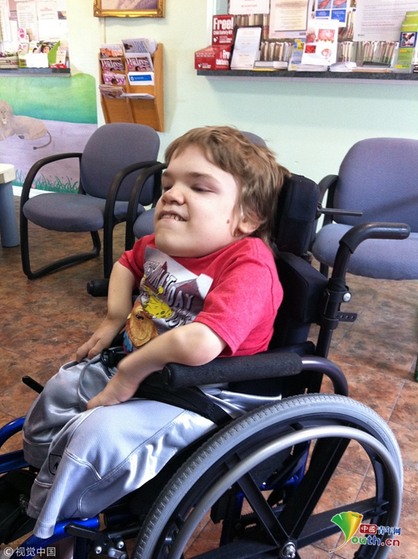 美国18岁少年患罕见侏儒症 体型如幼儿