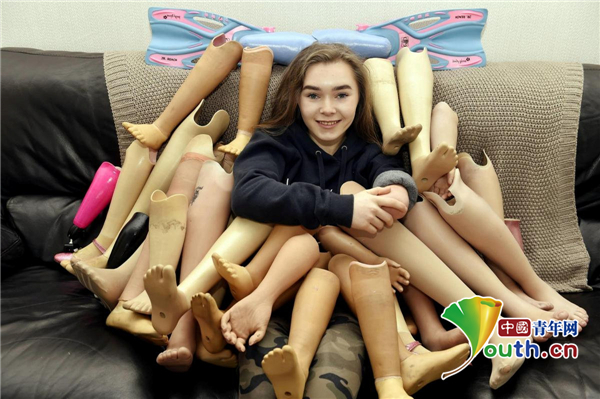 善良女孩因病失去双腿及左臂向慈善机构捐赠25副义肢