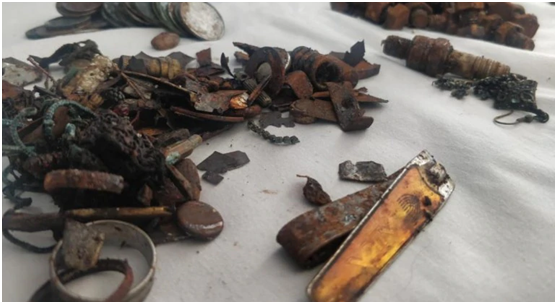 印度男子因胃痛就医 医生从胃里取出452个金属